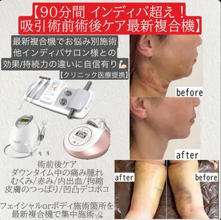 医療提携術後ケア痩身 専門サロン池袋のエステ・リラクイメージ