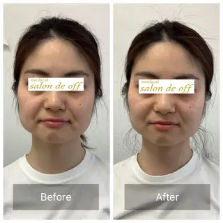 メディカルサロンドオフ所属・ハリサロンドオフ 美容鍼灸×小顔整体のエステ・リラクイメージ
