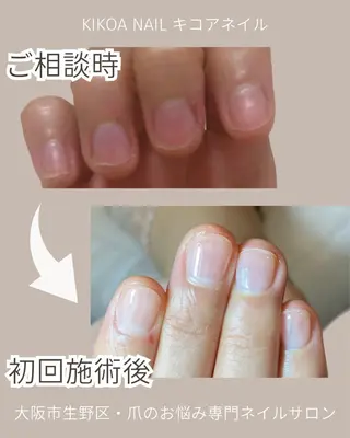 ネイル KIKOA NAIL キコアネイルのネイルデザイン