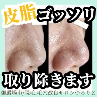 美肌脱毛サロン つるりと御殿場店所属・美肌脱毛サロン つるりとのその他イメージ