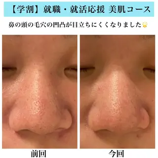 Bellesthe （ベルエステ）のエステ・リラクイメージ