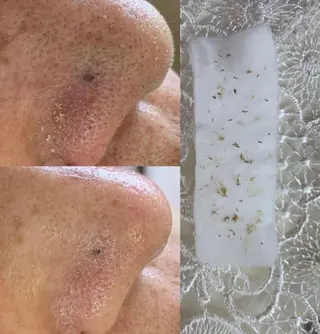 private salon  Dea_maris シュガーリング＆パーソナルボディケア所属・シミ改善・韓国肌管理 ボディメイク痩身のその他イメージ