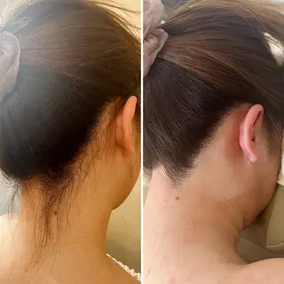 うなじ脱毛/美肌脱毛 LABELのエステ・リラクイメージ