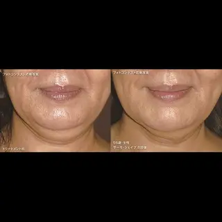 くびれ作り専門サロン こねこのシッポ虎ノ門のエステ・リラクイメージ