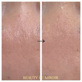 ビューティー ミロワールのエステ・リラクイメージ