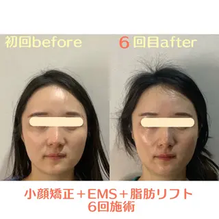 最速小顔・肌質管理 ❣️エスポワールのエステ・リラクイメージ