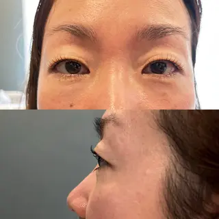 マツエク・マツパ 村木 恵里のマツエク・マツパデザイン