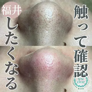 毛穴ケア専門サロン Yourmeユアミーのエステ・リラクイメージ