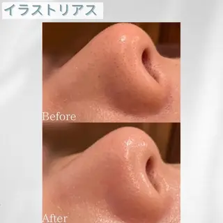 🫧ビュースタ 伊藤🫧のエステ・リラクイメージ