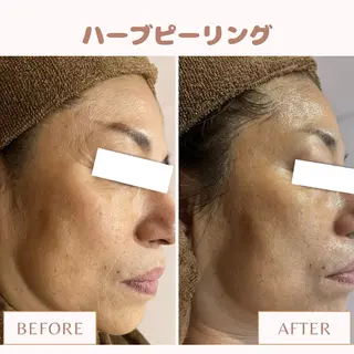 メンズ キッズ Amaryllis 🌹松本のエステ・リラクイメージ