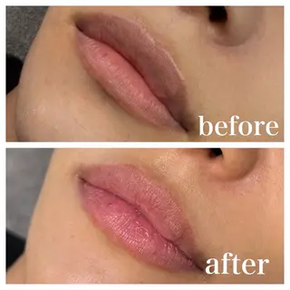 医療提携La Luna Keiのエステ・リラクイメージ