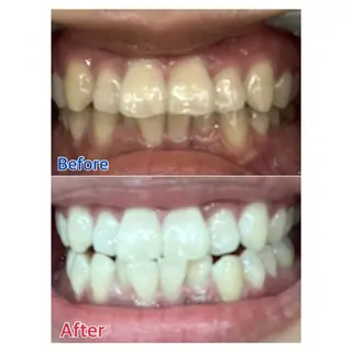 MBEAUTYSALON 千葉店・京成大久保所属・Melty 輝のその他イメージ