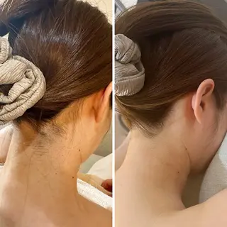 うなじ脱毛/美肌脱毛 LABELのエステ・リラクイメージ