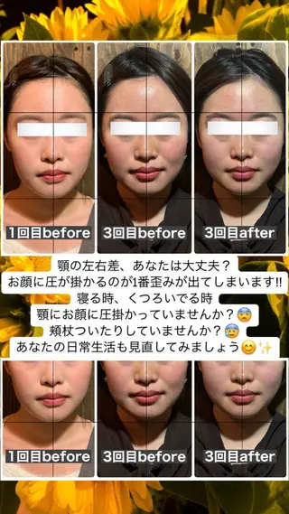 💎後悔させない小顔 矯正💎イトヤマ🌱のエステ・リラクイメージ