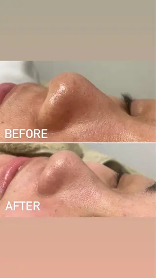 セミロング カラー パーマ ヘアアレンジ メンズ キッズ ネイル マツエク・マツパ アイブロウ 毛穴，ニキビ跡 改善総合サロンのその他イメージ