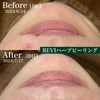 メンズ キッズ Amaryllis 🌹松本のエステ・リラクイメージ