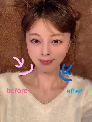 美容鍼灸サロン LOMIHARIのエステ・リラクイメージ