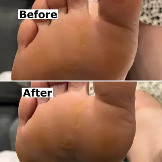 ネイル Mellow nail所属・巻爪無料モデル募集 ✨🦶MEGUMIのネイルデザイン