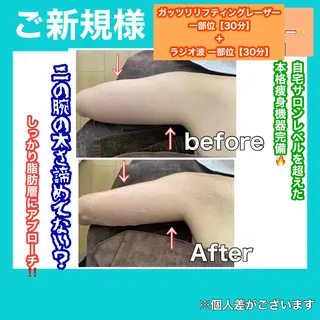 痩身/脱毛/ネイル HARUKAのエステ・リラクイメージ