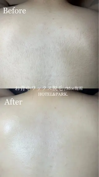 HOTEL&PARK .Moeワックス脱毛のエステ・リラクイメージ