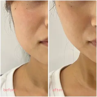 MORE BEAUTY ESTHE 本通り店所属・【シミ・シワ専門店】 山本 藍美のエステ・リラクイメージ
