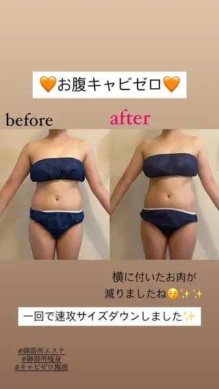 Salon de Lino 御器所のエステ・リラクイメージ