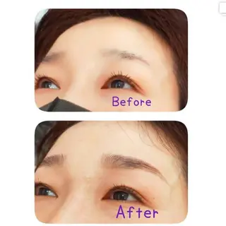 marron所属・痩身ハイパーナイフ ララピールリアボーテのエステ・リラクイメージ