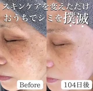 シミケア専門店 &More所属・シミケア専門店 &Moreのエステ・リラクイメージ