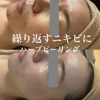 WHITE AQUA 北千住店のエステ・リラクイメージ