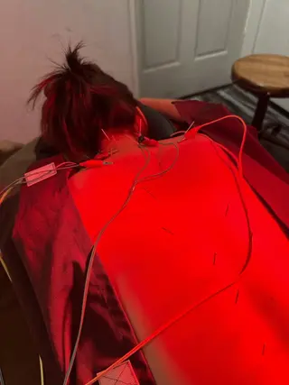 美容鍼灸整体サロンBeauJu所属・小顔矯/美容鍼/鍼灸 BeauJuのその他イメージ