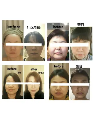 小顔と美肌 まごころエステMatoria所属・小顔 美肌専門 Matoriaのエステ・リラクイメージ