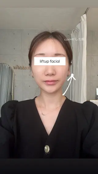 小顔専門salon miélu ミエルのエステ・リラクイメージ