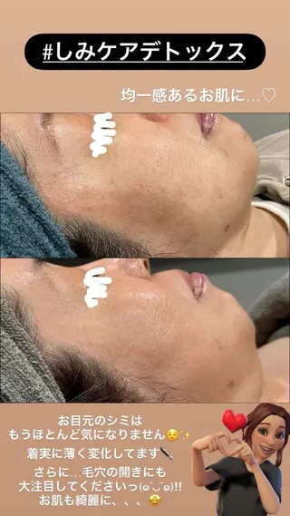 LiZA エステティックサロンのエステ・リラクイメージ