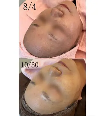 肌質改善|美眉サロンCannone'所属・肌質改善|美眉サロン Cannone’のエステ・リラクイメージ