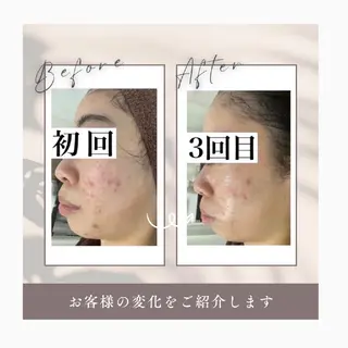 WhiteAqua 博多店　Erikoのエステ・リラクイメージ