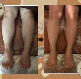 小顔コルギ&よもぎ蒸しサロンLINKA所属・小顔&美肌 サロンLINKAのエステ・リラクイメージ