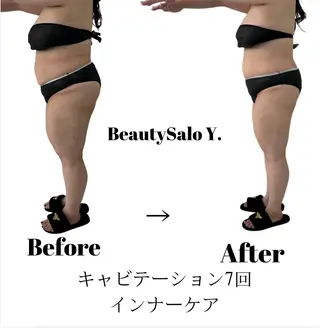 ダイエット専門店 Y.【ワイドット】のエステ・リラクイメージ