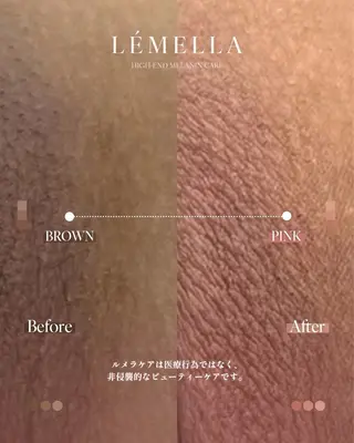 NAIL＆EYELASH SALON Lovers MOMO ～ラヴァーズ モモ～所属・Lovers MOMOのエステ・リラクイメージ
