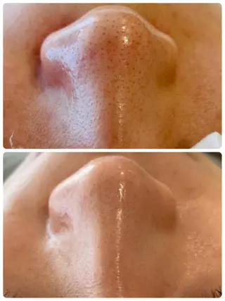 フェイシャル専門 肌質改善/プランスのエステ・リラクイメージ