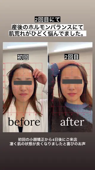 【福岡市西区 エステ】 GRANVIR(グランヴィール)所属・GRANVIR グランヴィールのエステ・リラクイメージ