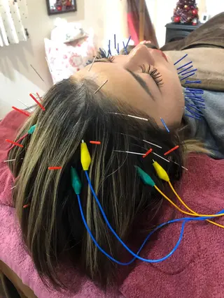 美容鍼灸女性専用 りんご鍼灸治療院のその他イメージ