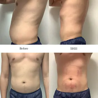 冷却専門店 SLARIのエステ・リラクイメージ