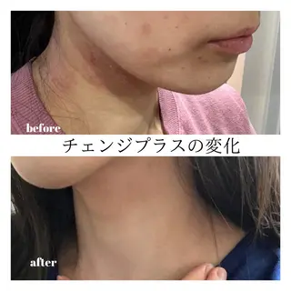 トータルビューティーサロンハルプラス所属・美肌・リラク ハルプラスのエステ・リラクイメージ