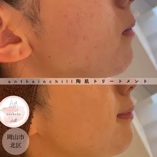 アンテインチル 山本のエステ・リラクイメージ