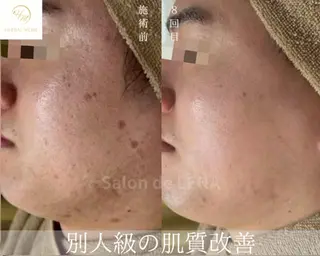 ハーブピーリング・毛穴ケア専門サロンSalon de LENA 栄店所属・ハーブピーリング専門 サロンドレナ　白藤のエステ・リラクイメージ