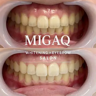 歯のホワイトニング専門店 MIGAQ 京都四条大宮店所属・佐藤 未来のその他イメージ