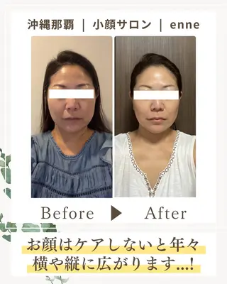 小顔サロンenne所属・小顔サロンenne 【エンネ】のその他イメージ