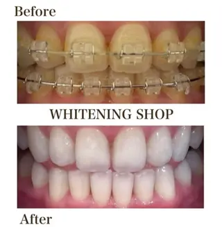 ホワイトニングショップ伊丹店所属・ホワイトニング ショップ伊丹店のその他イメージ