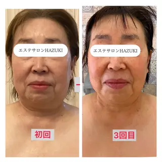 たるみ改善小顔エステ 堀葉月のその他イメージ