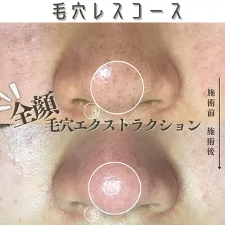 Muqu.所属・Muqu. 毛穴サロンのエステ・リラクイメージ